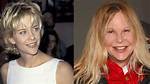 Meg Ryan Addresses Plastic Surgery Rumors in Glamour Interview