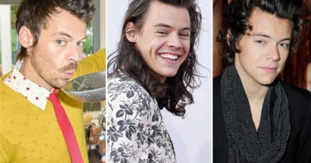 Morning over Harry Styles’ Hair- Meet the Bald & the Beautiful