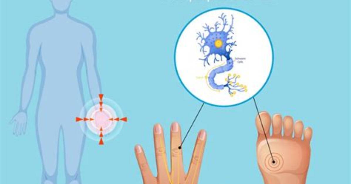Neuropathy