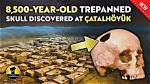 New Discovery: 8,500-Year-Old Trepanned Human Skull Discovered at Çatalhöyük