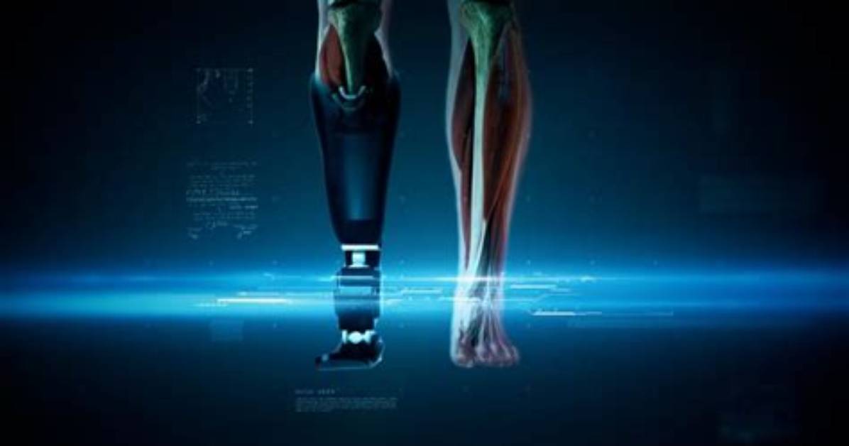 Nova | the Evolution of Prosthetic Leg Technology | Season 49 | Episode 4