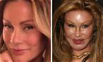 Plastic Surgery Gone Wrong: Celebs Who Regret Going Under the Knife and Other Cosmetic Procedures