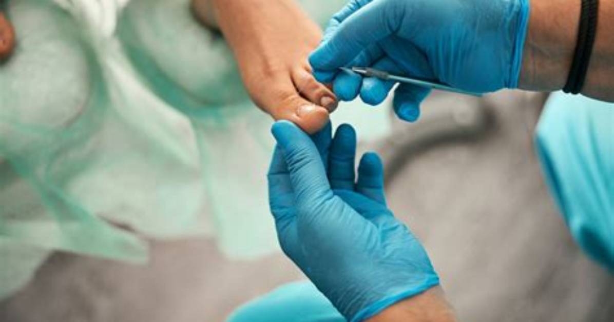 Podiatrist Near Me | Bay Area Foot Care San Leandro, Ca