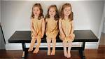 Rare Identical Triplets -- Two of Which Are Conjoined -- Born in Texas