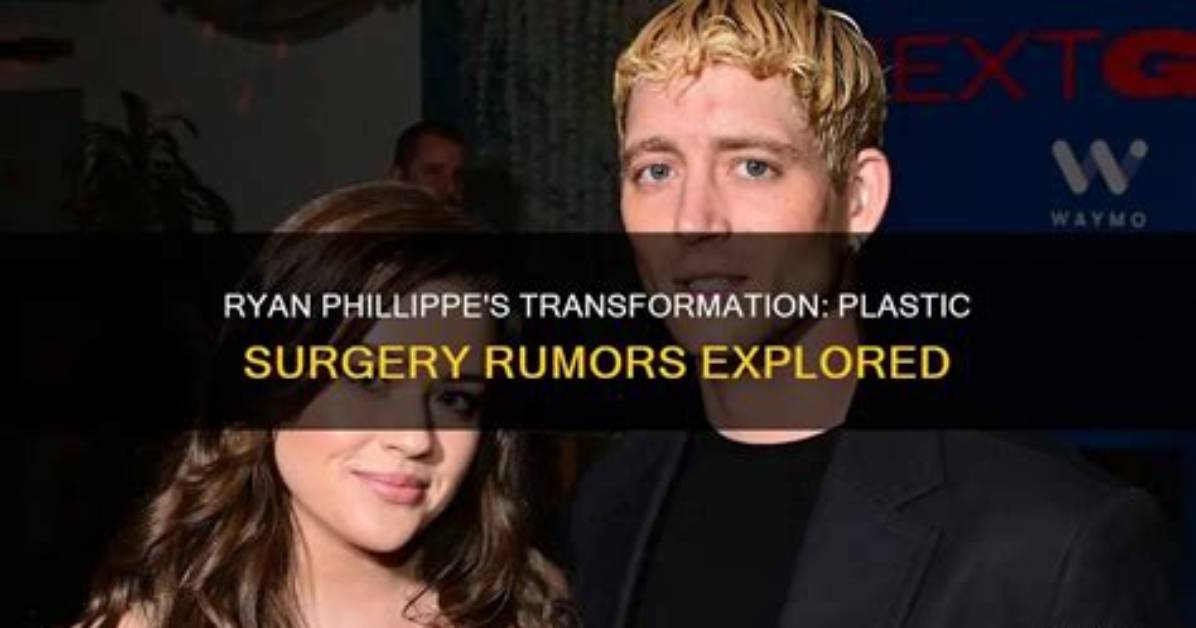 Ryan Phillippe Plastic Surgery Before and After