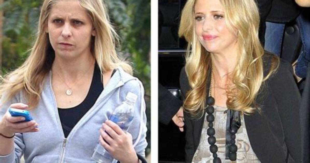 Sarah Michelle Gellar Chirurgie
