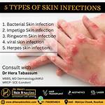 Skin Infections