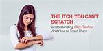 The Itch You Can't Scratch