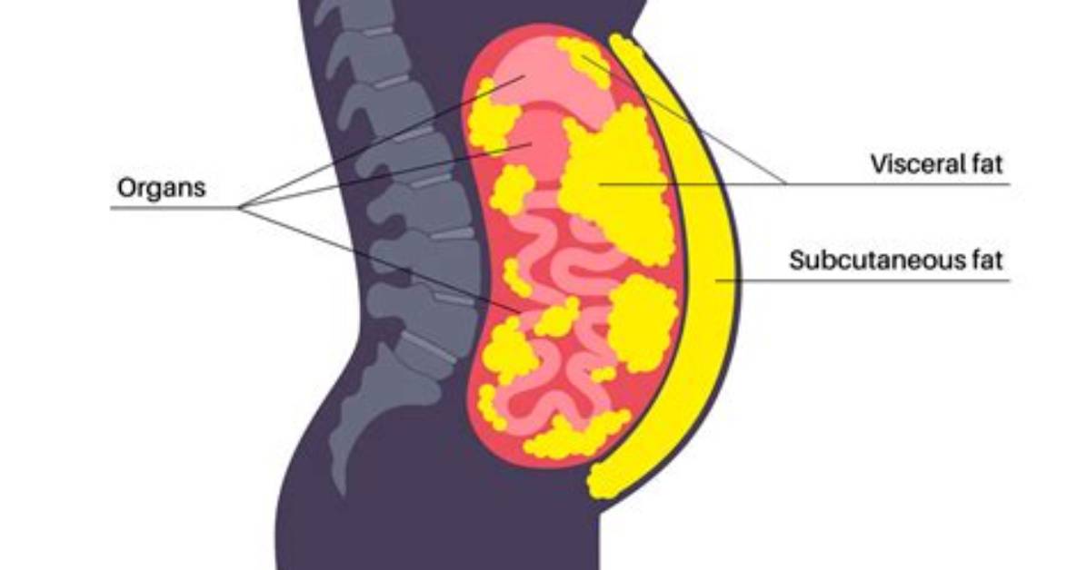 The Visceral Body in Medicine | the Visceral Body in Medicine