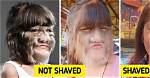 The World’s Hairiest Girl Is Completely Shaved, and She Looks Unrecognizable Now