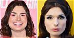 Trans Icon Dylan Mulvaney Reveals the Results of Her Facial Feminization Surgery