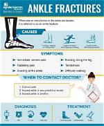 Treatment of an Ankle Fracture