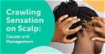 Understanding the Crawling Sensation in Scalp