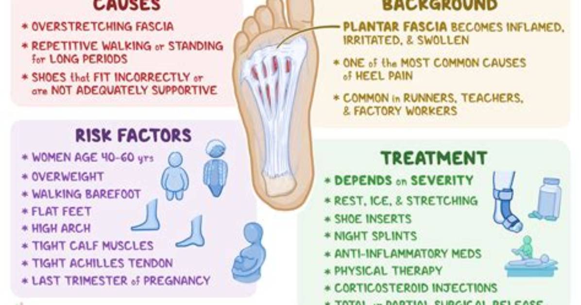 What Causes Plantar Fasciitis?