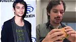 What Happened to Devon Bostick’s Face? Plastic Surgery Before and After