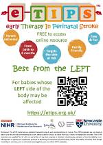 What Is a Perinatal Stroke; eTIPS Best from the Left; Newcastle University