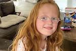 What Is Going on with Hazel Busby's Eye Condition
