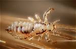 What Race Gets Lice the Most the Talks Today
