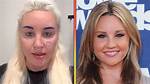 Where Is Amanda Bynes Now, What Happened to Her? Details on Her Health Condition Explained