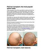 Which Hair Transplant Option Is the Most Suitable for Me?