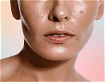 Which Is Better for Oily Skin?