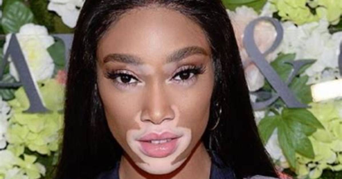 Winnie Harlow Biography - Facts, Childhood, Family Life & Achievements