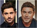 Zac Efron Chirurgie Esthetique